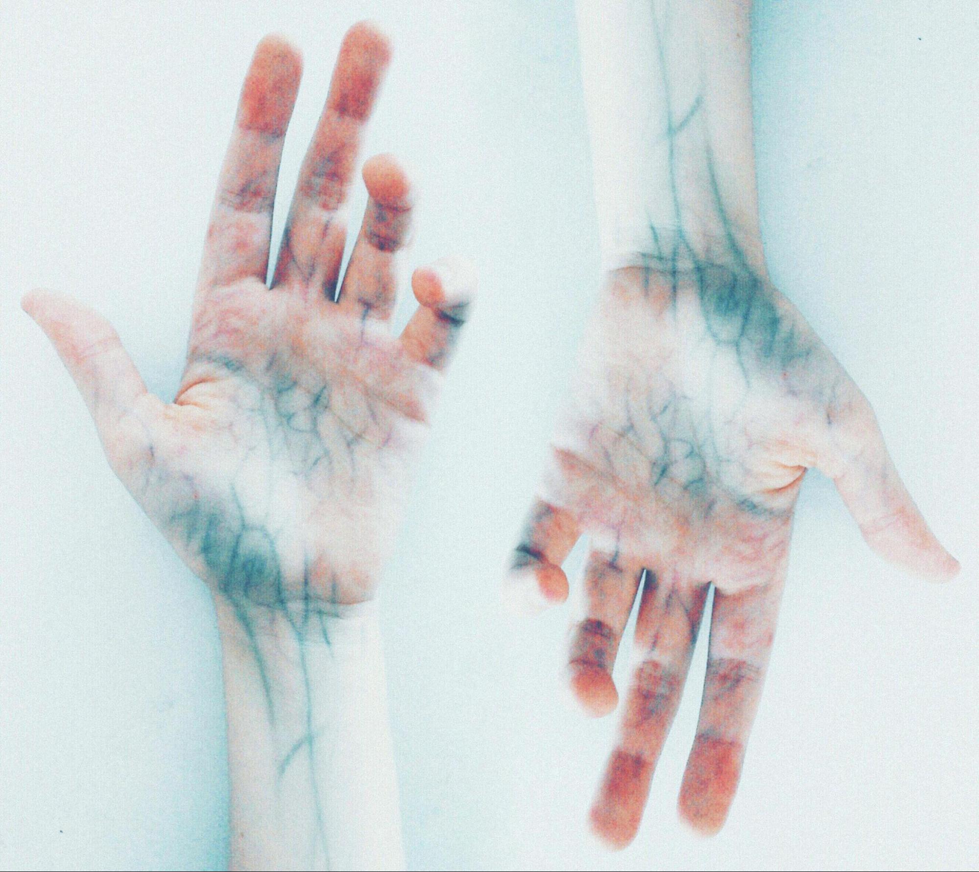 CBD for Nerve Pain- How It Works and What to Expect